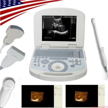 Laptop Ultrasound scanner w Convex+Linear+Micro-convex +Transvaginal 4 Probes