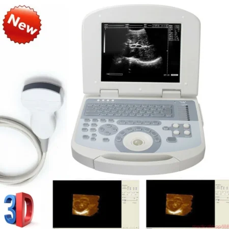Laptop Ultrasound scanner w Convex+Linear+Micro-convex +Transvaginal 4 Probes