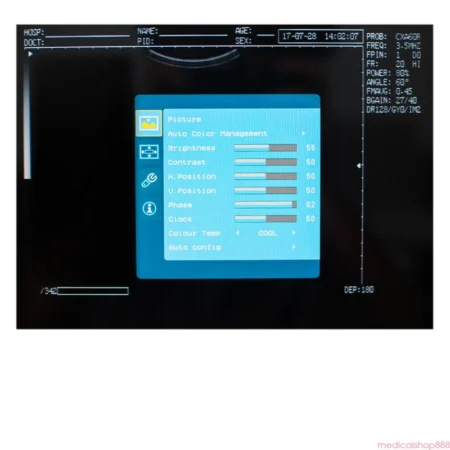 Laptop Ultrasound scanner w Convex+Linear+Micro-convex +Transvaginal 4 Probes